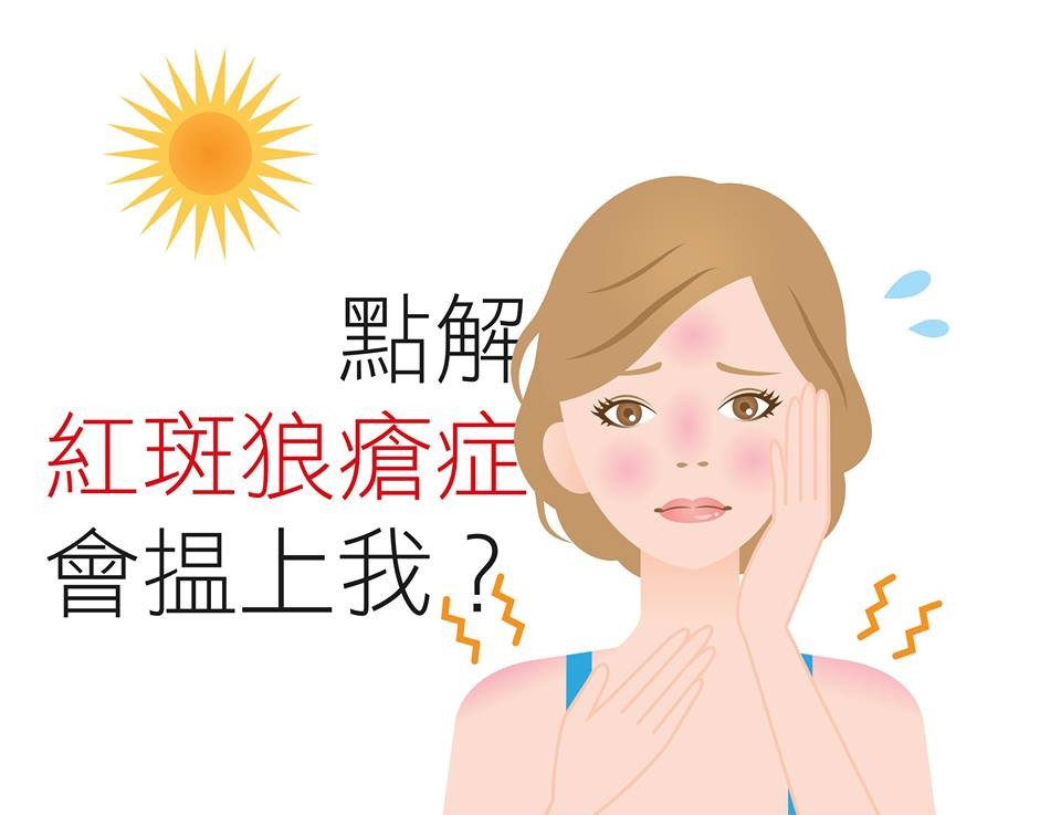 狼瘡