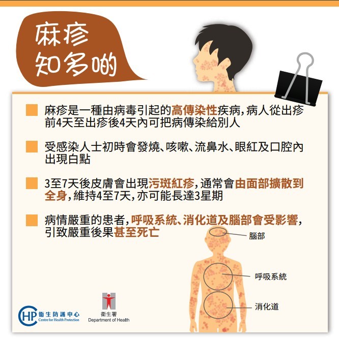 麻疹