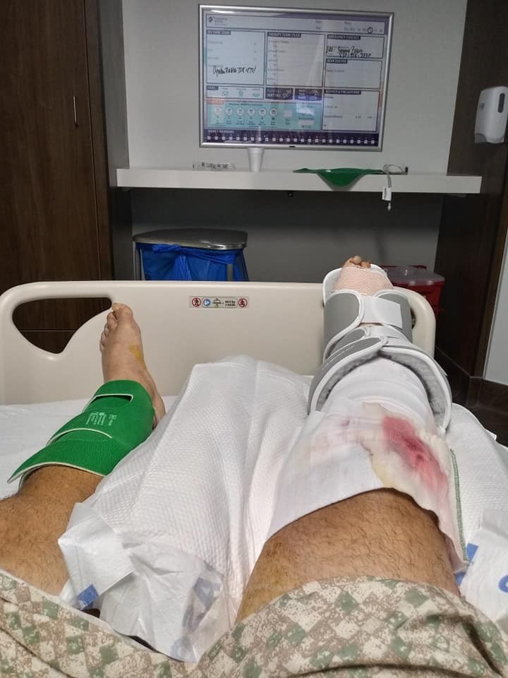 【樂極生悲】中年男公園水池浸腳 感染弧菌需切除右腿腐肉