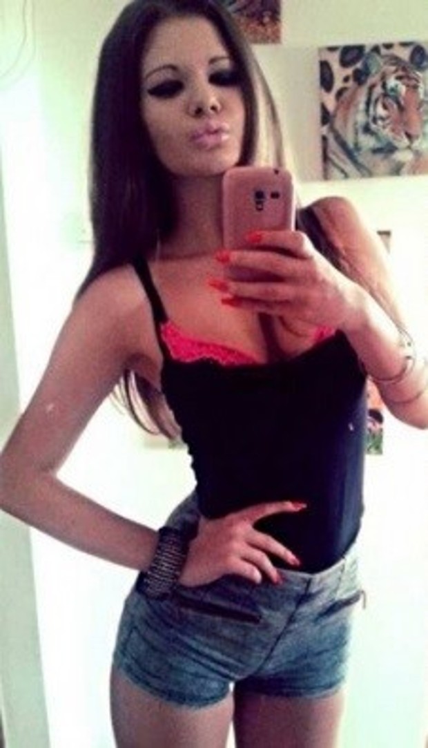 【真人芭比】21歲少女夢想成為Barbie 無悔一年整容15次 