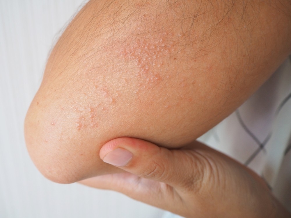 shutterstock_1287320836