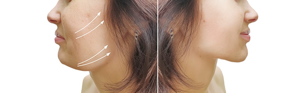 shutterstock_1430113319