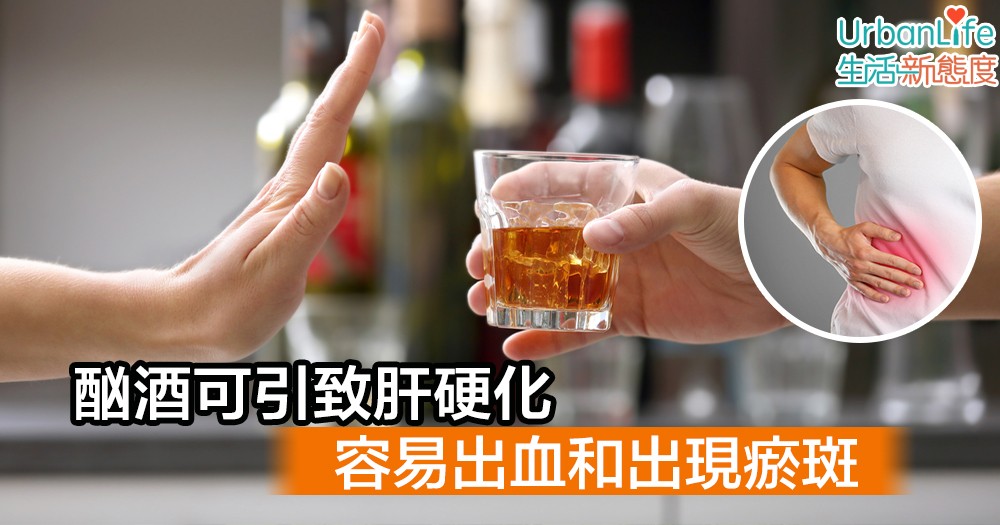 【男性常見疾病】酗酒可引致肝硬化 容易出血和出現瘀斑