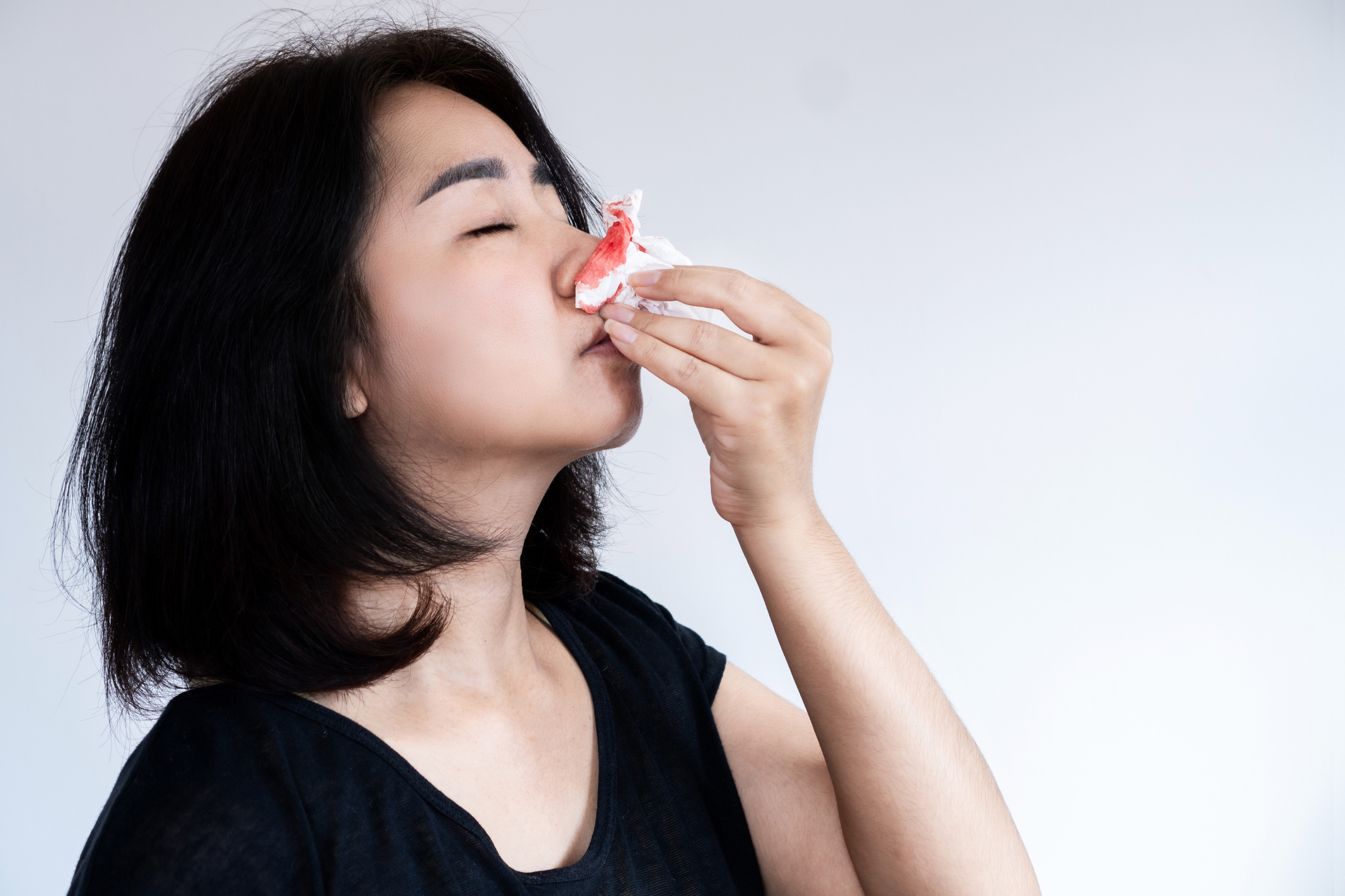 流鼻血時應該怎麼做?要如何才能止血?