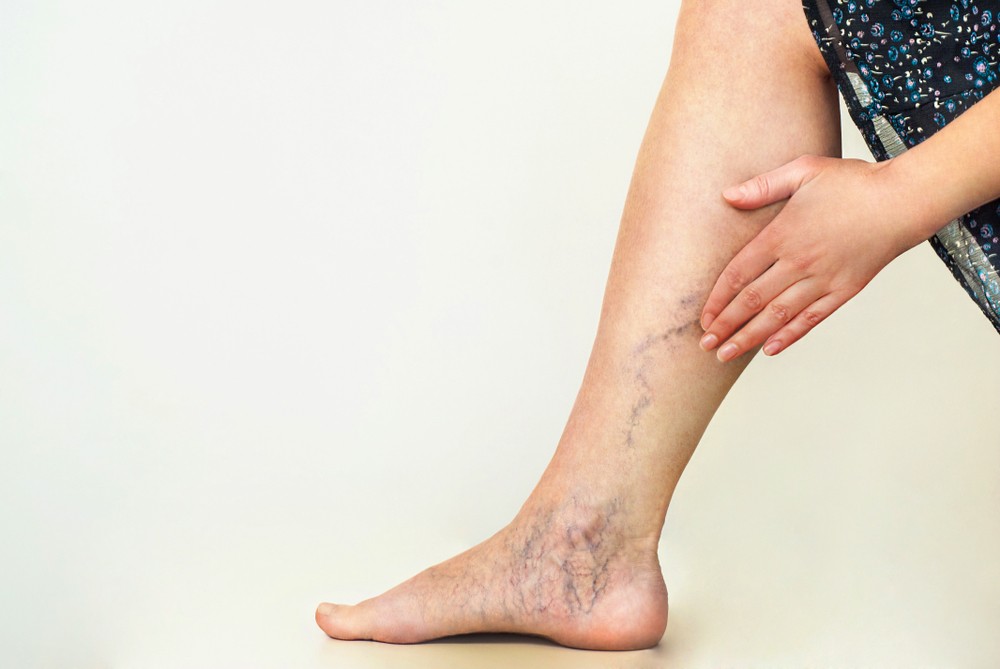 leg