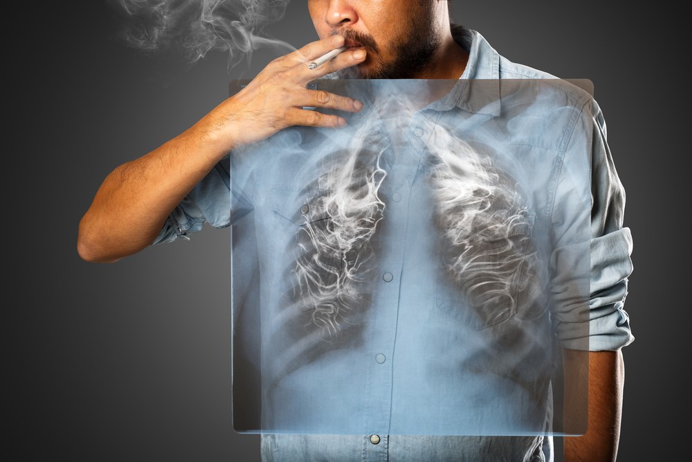 shutterstock_286789925