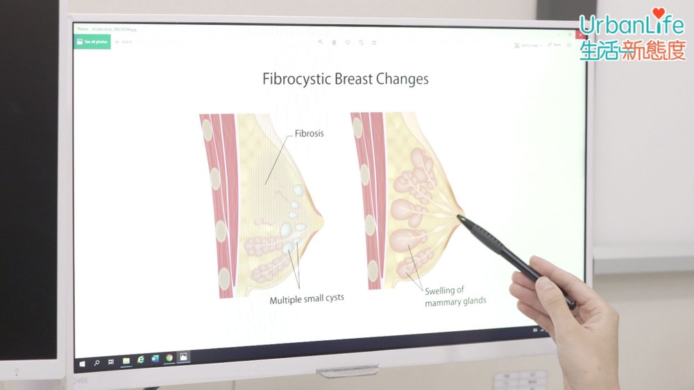 乳癌並非單一成因的疾病。