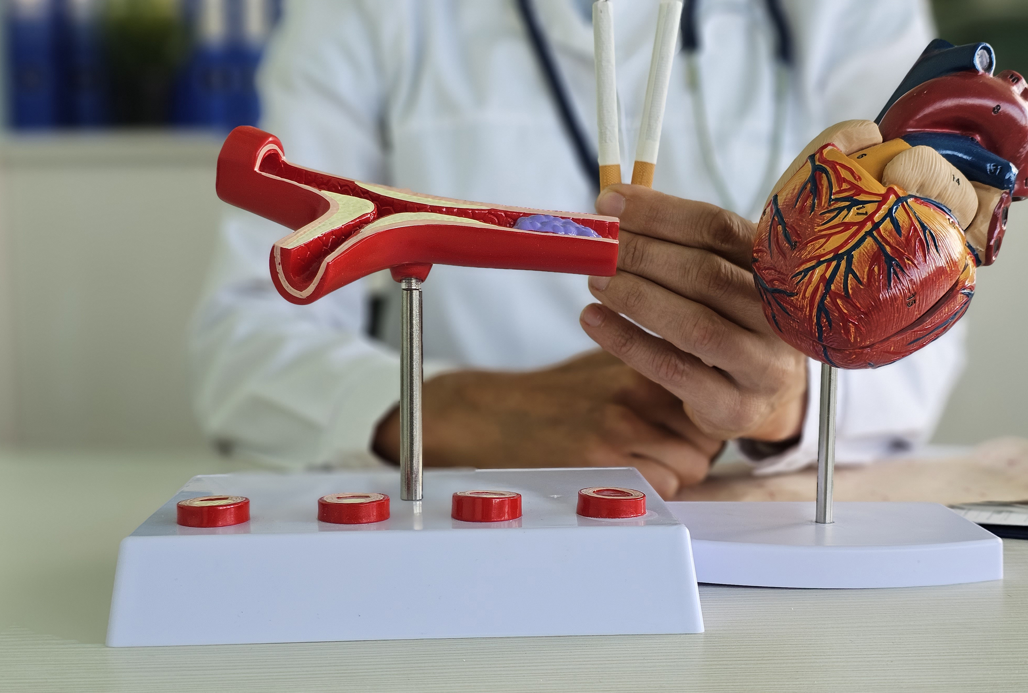 根據美國的統計,大約五分之一的心臟病發死亡病例起因於長期抽煙。