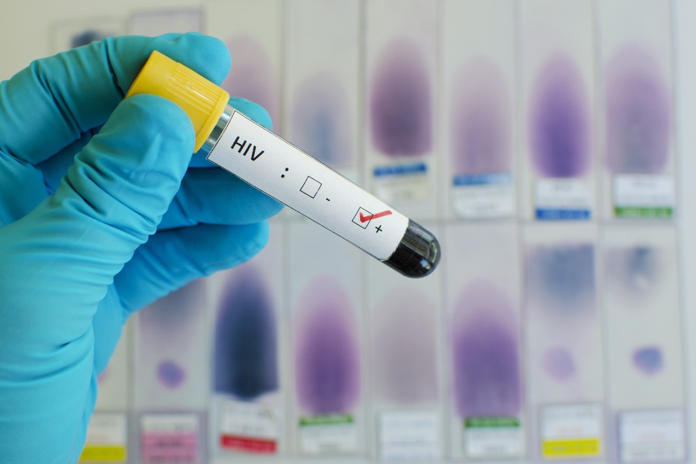 目前尚不清楚這種新型愛滋病毒HIV-1群M型會如何影響身體健康。
