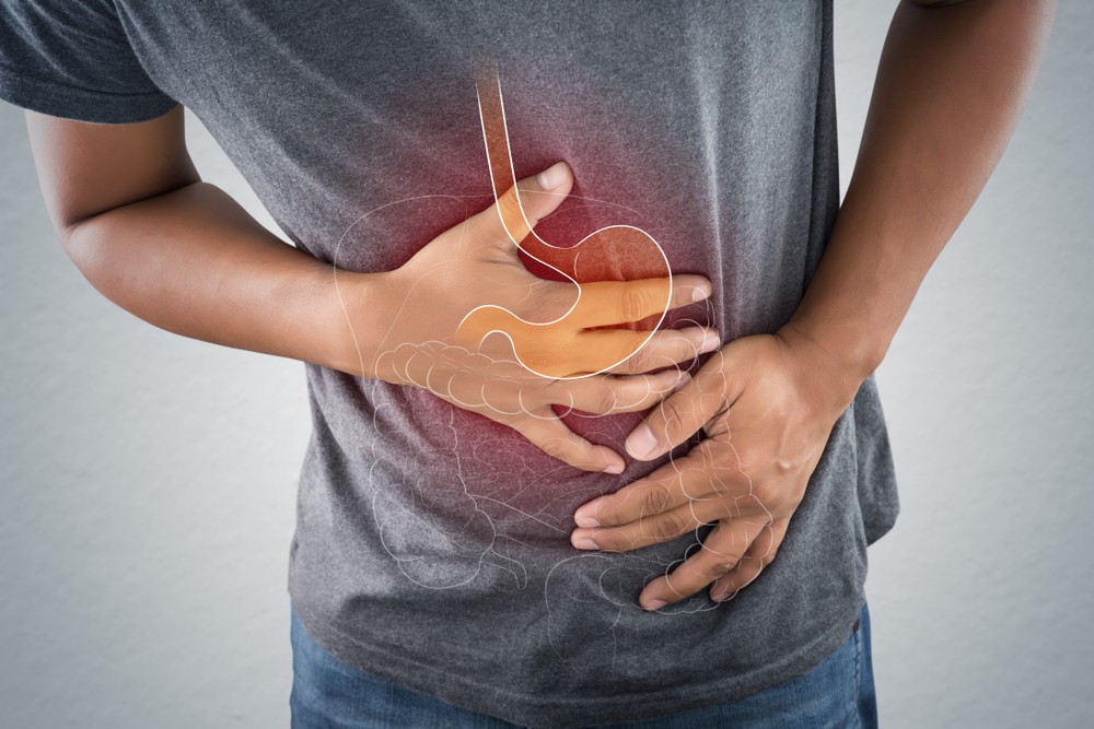胃潰瘍是消化性潰瘍( peptic ulcer disease)的其中一種。