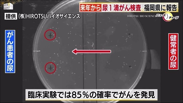 日本有企業研發出用1滴尿驗出乳癌、大腸癌等15種癌症,聲稱準確率達85%。