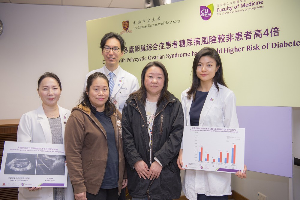 香港中文大學(中大)醫學院的一項最新研究發現,患有多囊卵巢綜合症的華人女性患上二型糖尿病的風險比非患病人士高4倍。