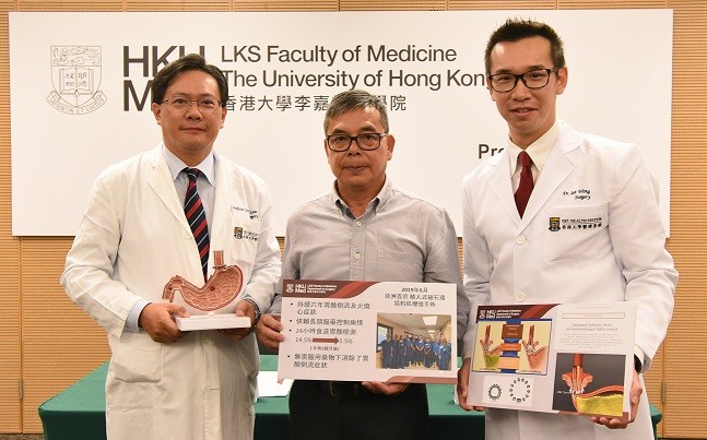 港大醫學院完成亞洲首宗以植入式磁石環增強下食道括約肌功能手術以治療胃酸倒流。