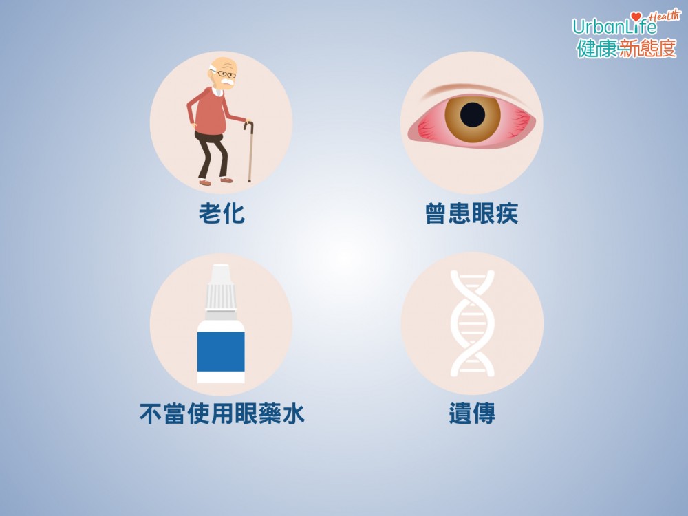 白內障高危因素主要有四個,老化、曾患眼疾、不當使用眼藥水、遺傳,而最常見的成因就是老化。