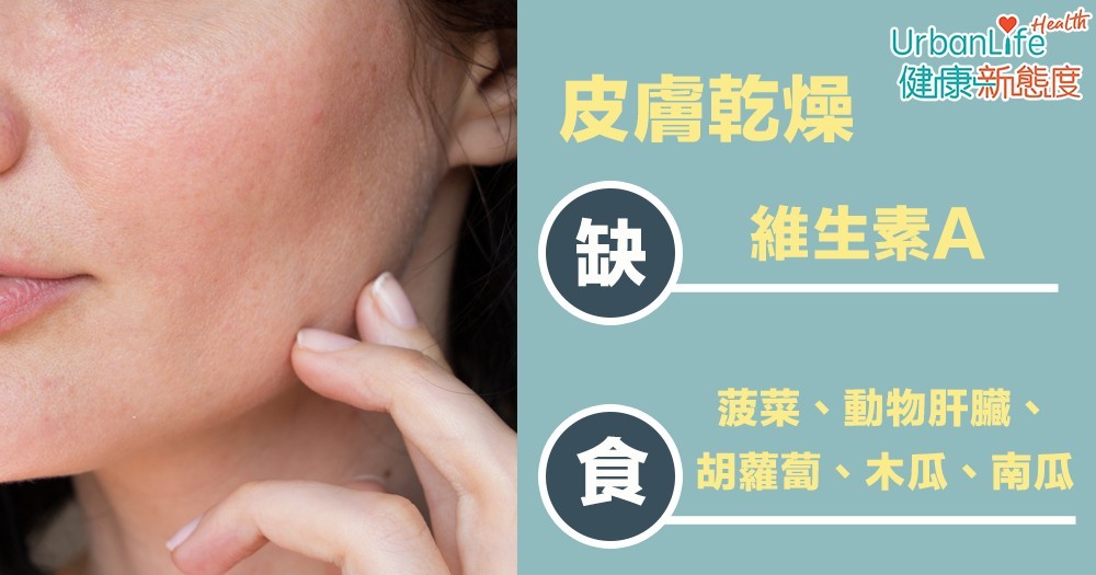 皮膚乾燥