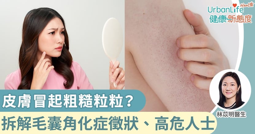 毛囊角化症 皮膚生粗糙粒粒 拆解毛囊角化症徵狀 高危人士 Urbanlife 健康新態度