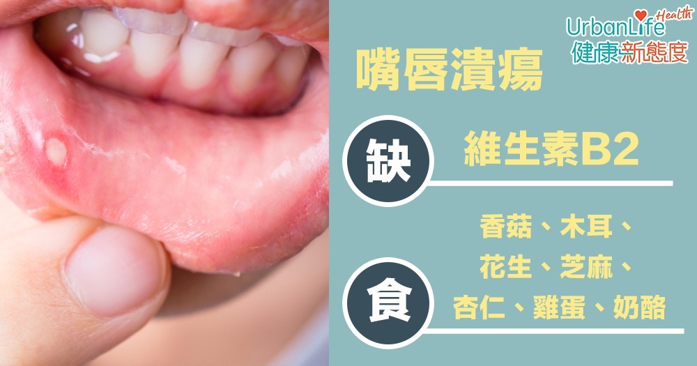 嘴唇潰瘍