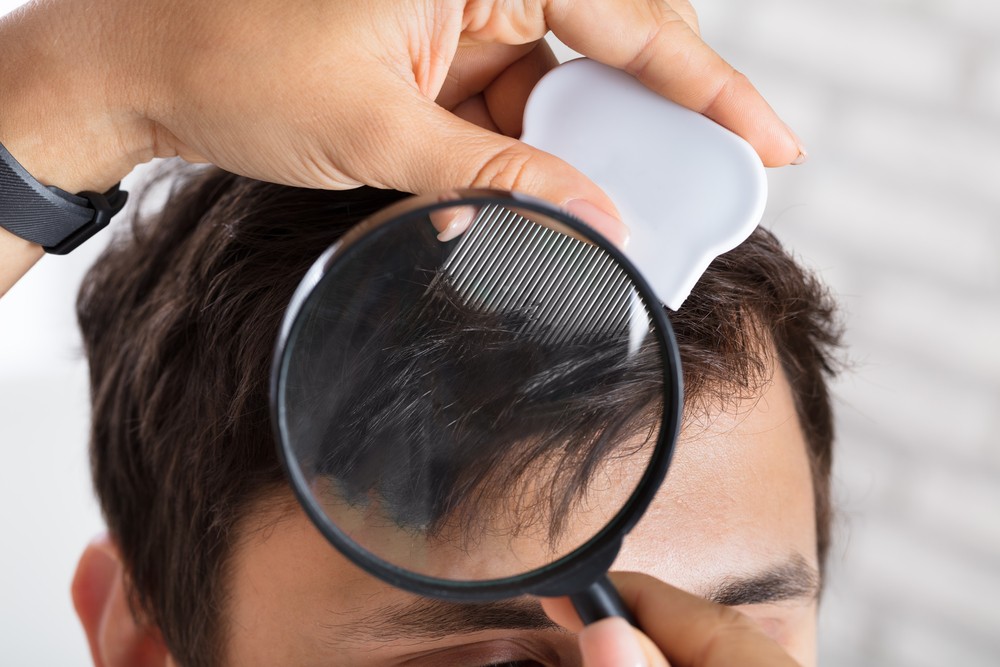 跳蚤是一種寄生蟲，常會於人類頭部、腹股溝或身體其他地方叮咬，它亦會對身體有毛髮的地方造成損害，包括胸部、腋下、眉毛、睫毛及鬍鬚。