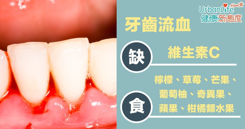 牙齒流血