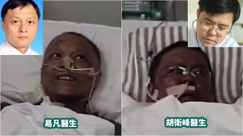染疫醫生易凡和胡衛峰,痊癒後面色發黑。