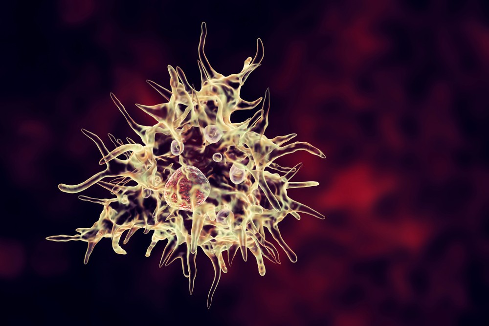 棘阿米巴角膜炎(Ancanthamoeba keratitis)是一種由阿米巴變形蟲引起的角膜感染。