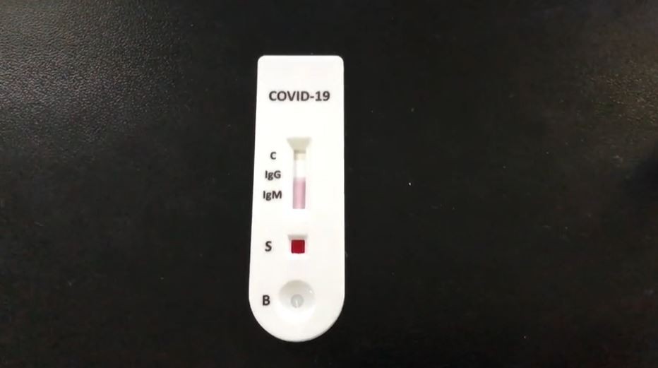 美國史丹福大學近日推出一種新型抗體測試,並已於加洲聖克拉拉縣(Santa Clara County)為逾3千人進行檢測,以確定染疫或康復比例。