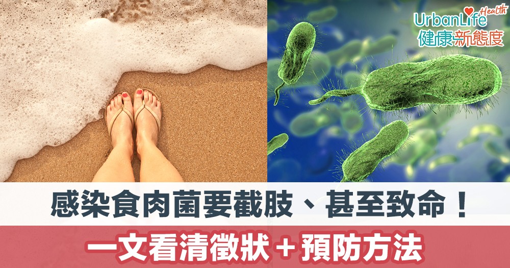 【食肉菌症狀】感染食肉菌要截肢、甚至致命!一文看清徵狀+預防方法
