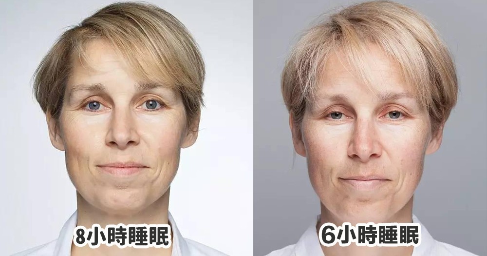 女記者分別連續5天只睡6個小時和8個小時，容貌不但變得憔悴蒼老，皮膚皺紋也增加了。