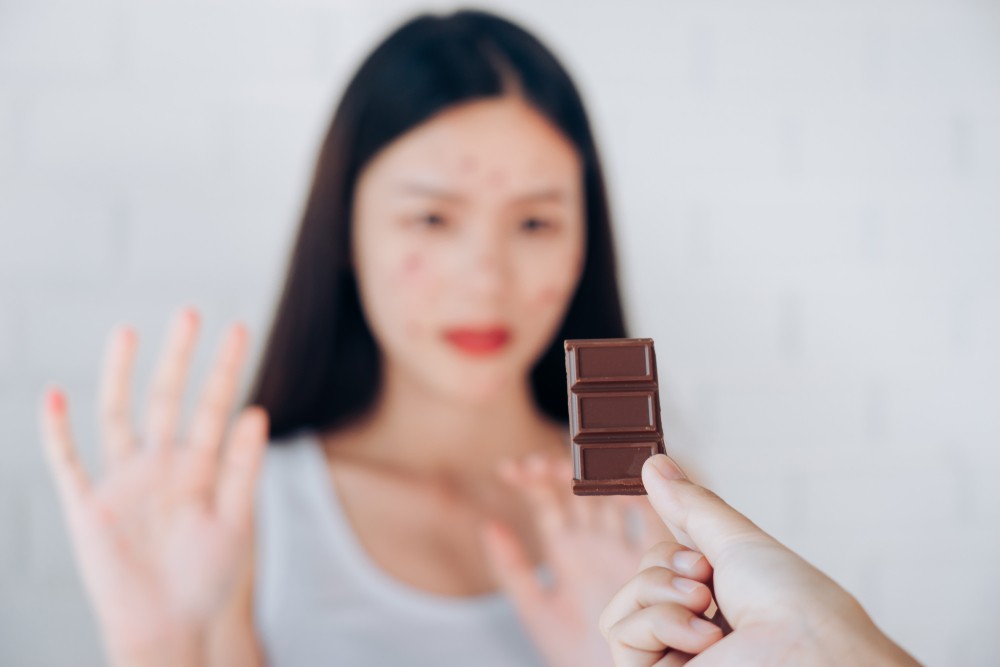 吃朱古力會長暗瘡的原因,並非因為可可豆,而是因為裡面的添加糖及牛奶。