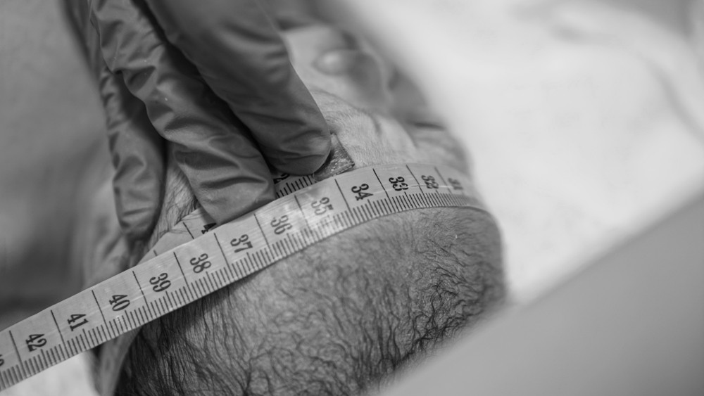 在1歲以前的嬰兒頭圍應該在34釐米左右。