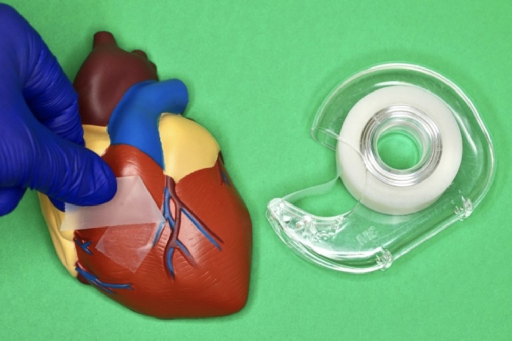 麻省理工學院的研究團隊早前開發了一款新型手術膠布 ，可快速密封內臟傷口。