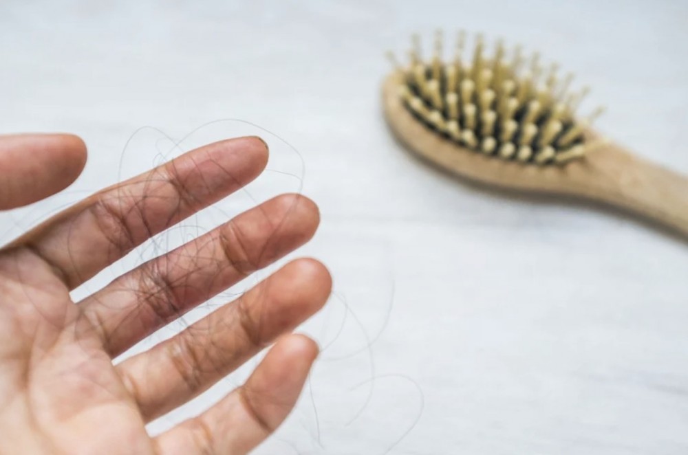 雄激素是導致男性脫髮的激素。