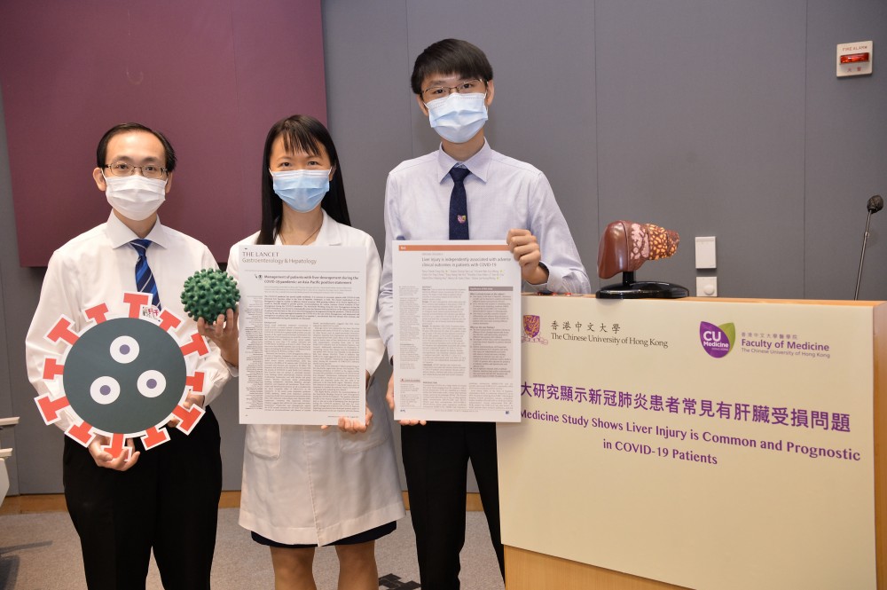 是次研究由黃煒燊教授、黃麗虹教授及葉卓風博士(左起)負責。(圖片來源:中大醫學院)