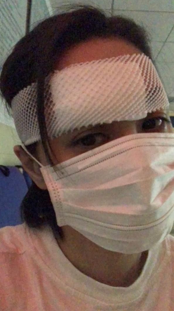 藝人阿嬌今日凌晨2點多起床打算走到洗手間,一時感到暈眩頭部撞到大理石邊緣,造成長達6cm的傷口。