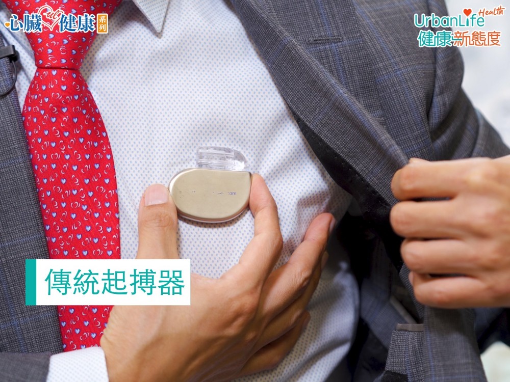 安裝傳統起博器時會在鎖骨下開一個2至3厘米長的傷口。