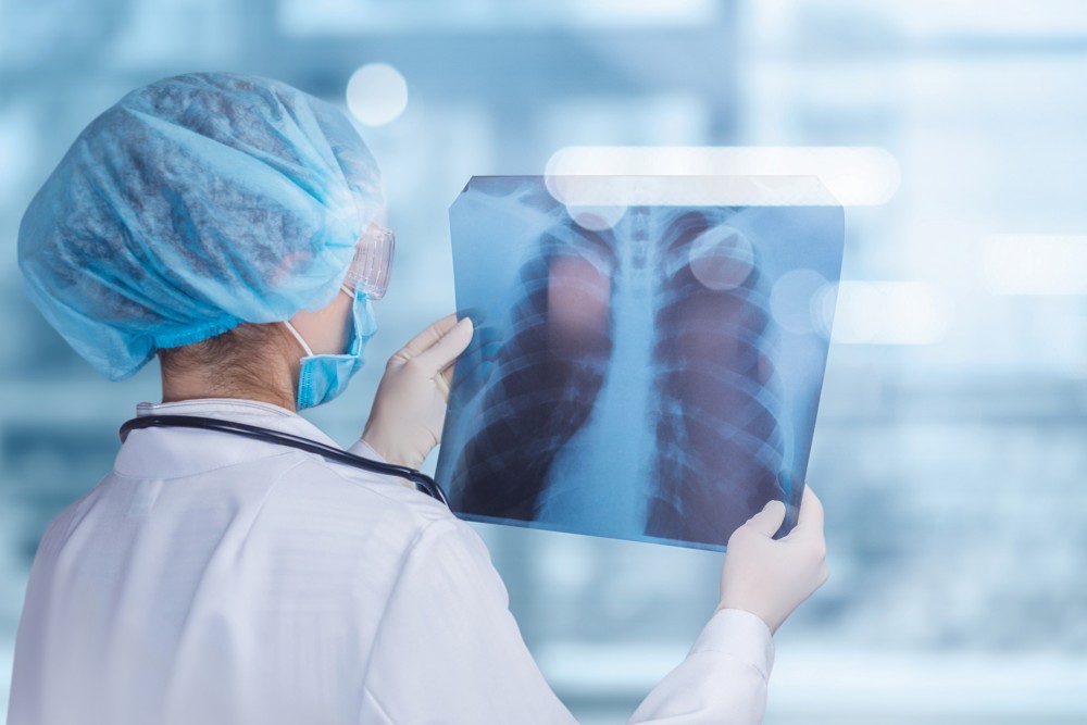 「肺花」即是肺部X光片出現白影,代表肺部有病變和受損害。