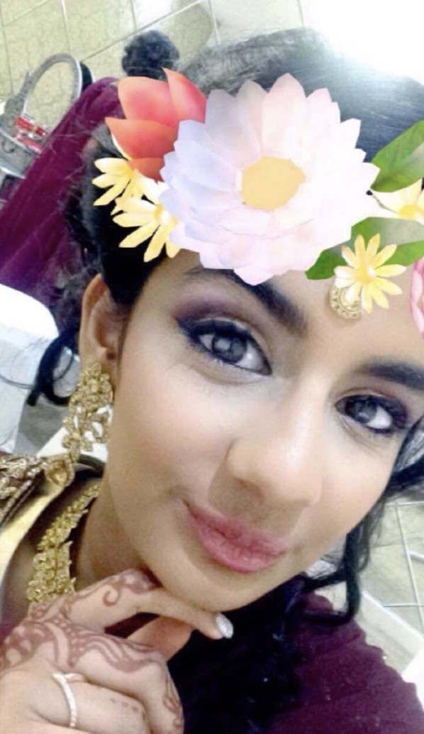 4年前(即2016年12月),英國少女Aleema Ali發現染上頭蝨,在家使用去頭蝨洗頭水洗頭,按指示讓洗髮水在頭髮停留5分鐘。