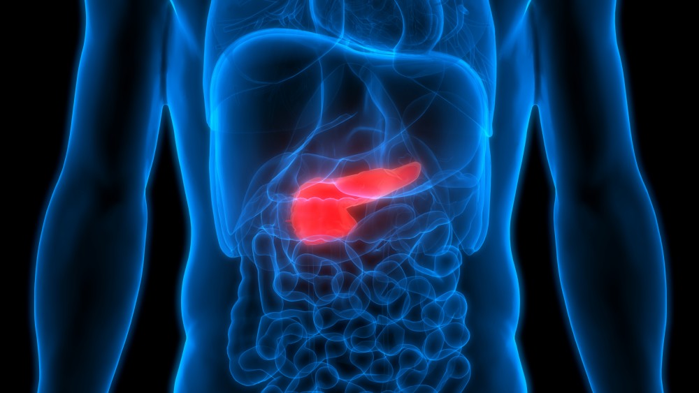 胰臟癌(Pancreatic Cancer)是本港第六大癌症殺手,每年有近五百人死於胰臟癌。