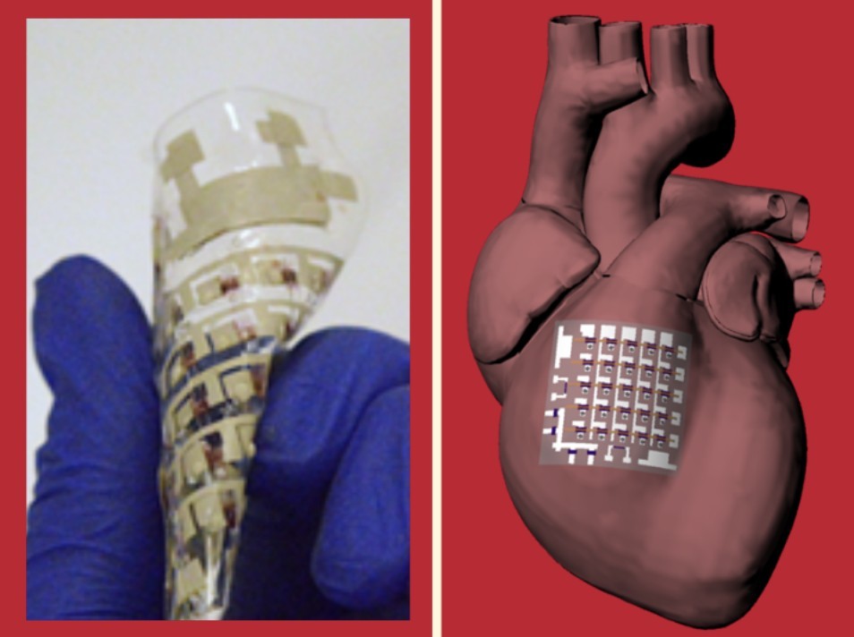 美國休斯頓大學研發全橡膠植入式心臟貼片,可直接放在心臟上,採集心臟的電生理活動、溫度及心跳等指標。