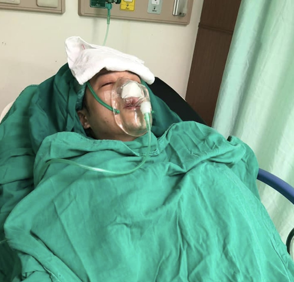 台灣藝人周湯豪早前在社交平台上傳了一張戴著氧氣罩,躺在病床的相片,嚇壞不少網友!原來他是因患鼻瘜肉,而需進行微創手術,目前已康復出院。