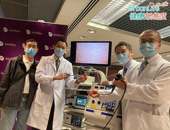 中大最新研究顯示,吸煙者患上膀胱癌的機會較高。
