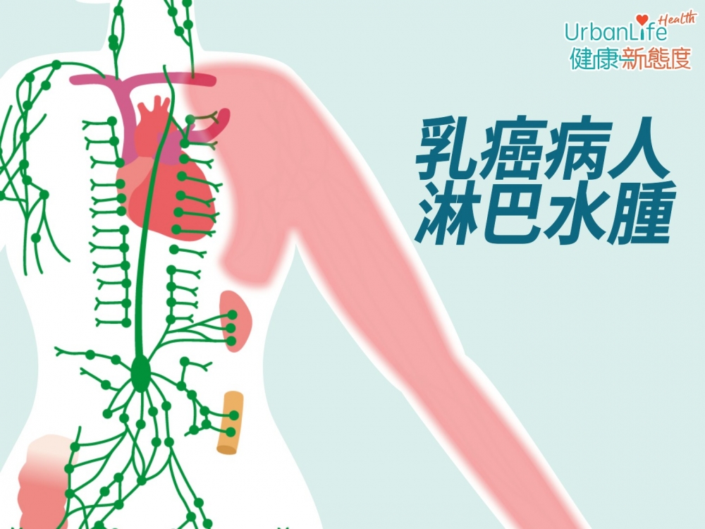 如果切除了10粒淋巴以上,手臂水腫的機會可達6至7成。