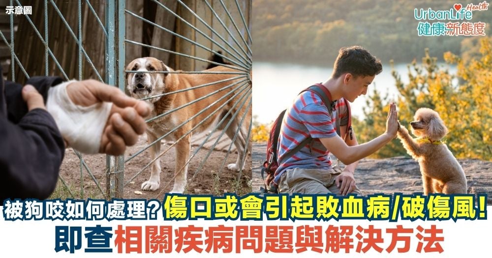 【狗咬人】狗咬傷口或引起敗血病！即查相關疾病與解決方法