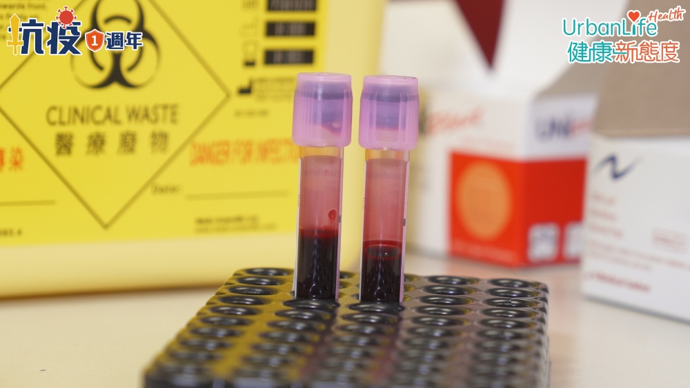 陳基湘教授指出,能找出隱形患者的唯一方法就是測試抗體。