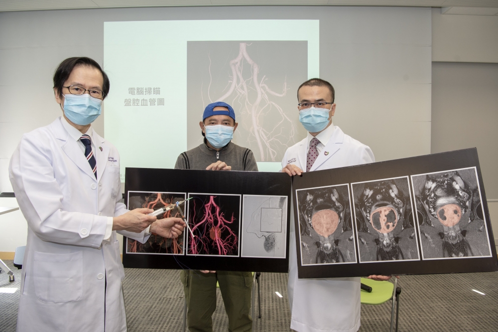 大醫學院2014年起研究以「前列腺動脈栓塞術」進行治療。