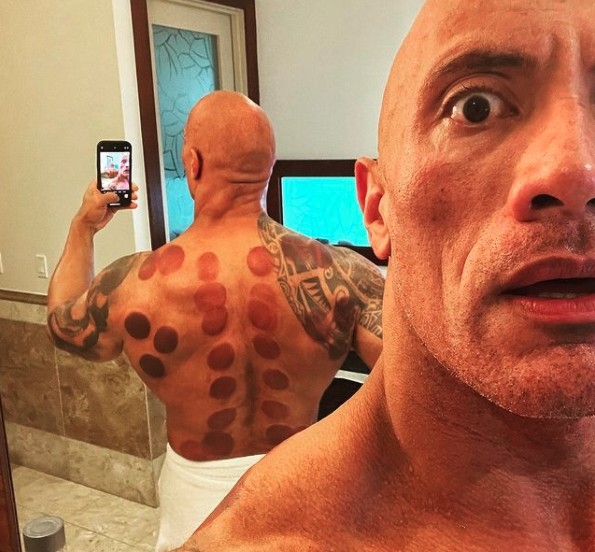 荷李活動作片男星狄維·莊遜（Dwayne Johnson）早前在社文平台上載自拍相片，表示自己是第一次嘗試拔罐，又直言「非常享受這個療法」。