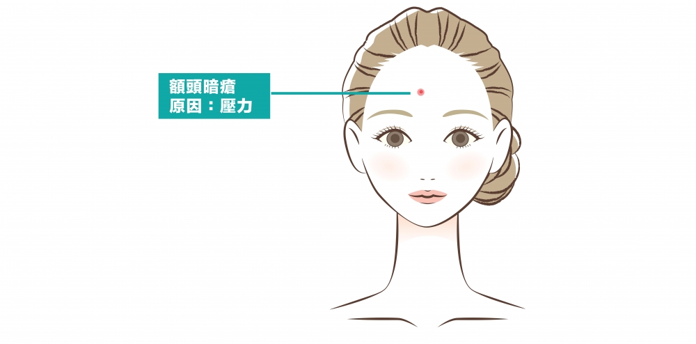 額頭代表著心臟,若額頭長出暗瘡則表示心火盛。