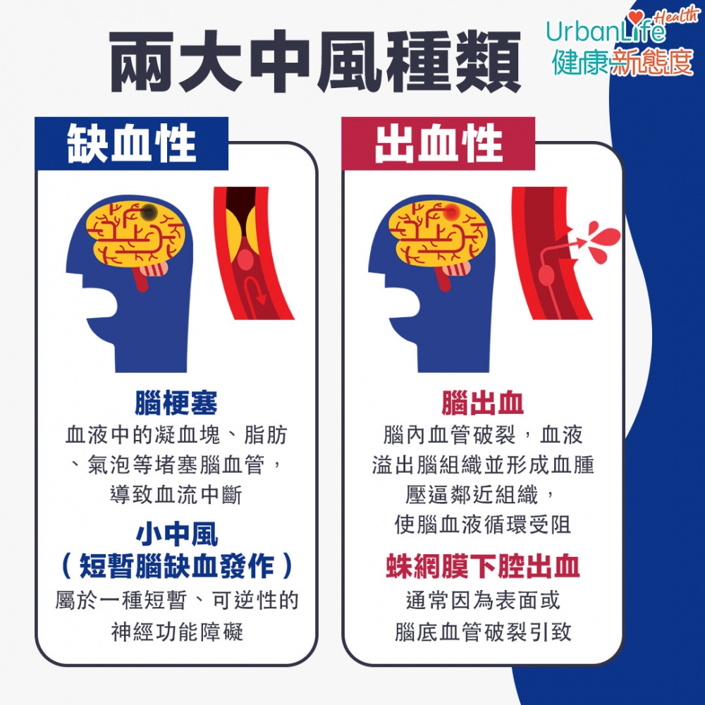 兩大中風種類。