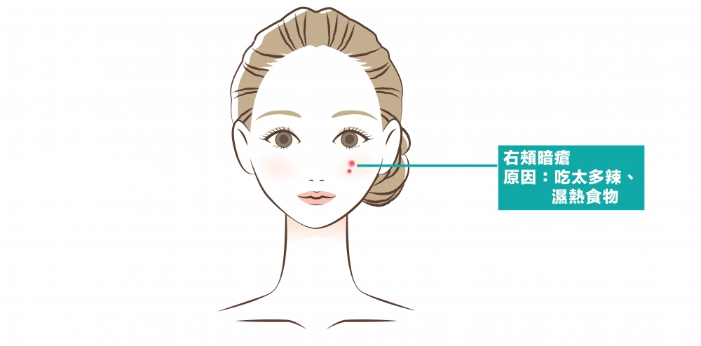 右頰代表著肺部,這裡長出暗瘡表示肺火蘊熱。