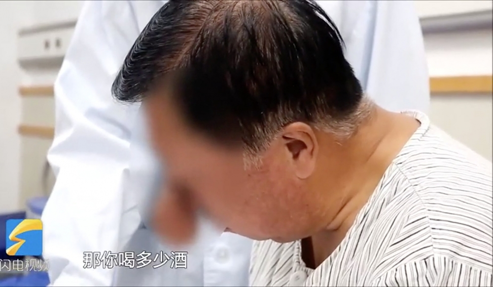 中國一名56歲的李姓男子4年前起鼻子愈來愈大,近月鼻子已可以蓋到下嘴唇。